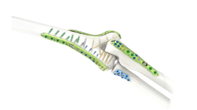 (IMAGE 1) ARIX ELBOW SYSTEM