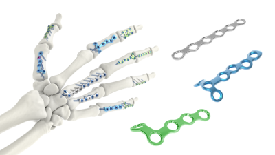 (IMAGE 1) ARIX HAND SYSTEM Comprehensive