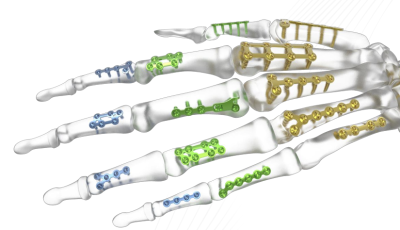 (IMAGE 2) ASTROLABE HAND