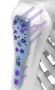 (IMAGE 2) ASTROLABE Small-Fragments