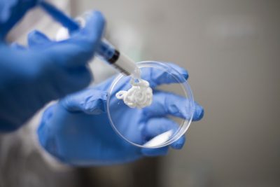 (IMAGE 2) BIONGRAFT BETA-TCP PUTTY SILICAT