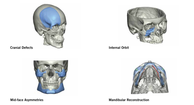 (IMAGE 2) OMNIPORE DESCRIPTION