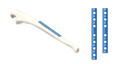 (IMAGE 2) One Third Tubular Plate