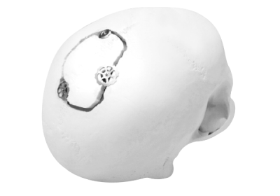 (IMAGE 2) SPEEDY FLAP