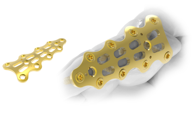 (IMAGE 3) FOOT Arrow Plate